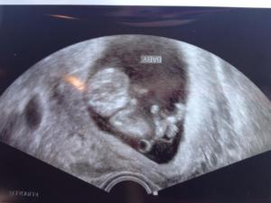 10259824_10152392418567416_7875262963364976340_n